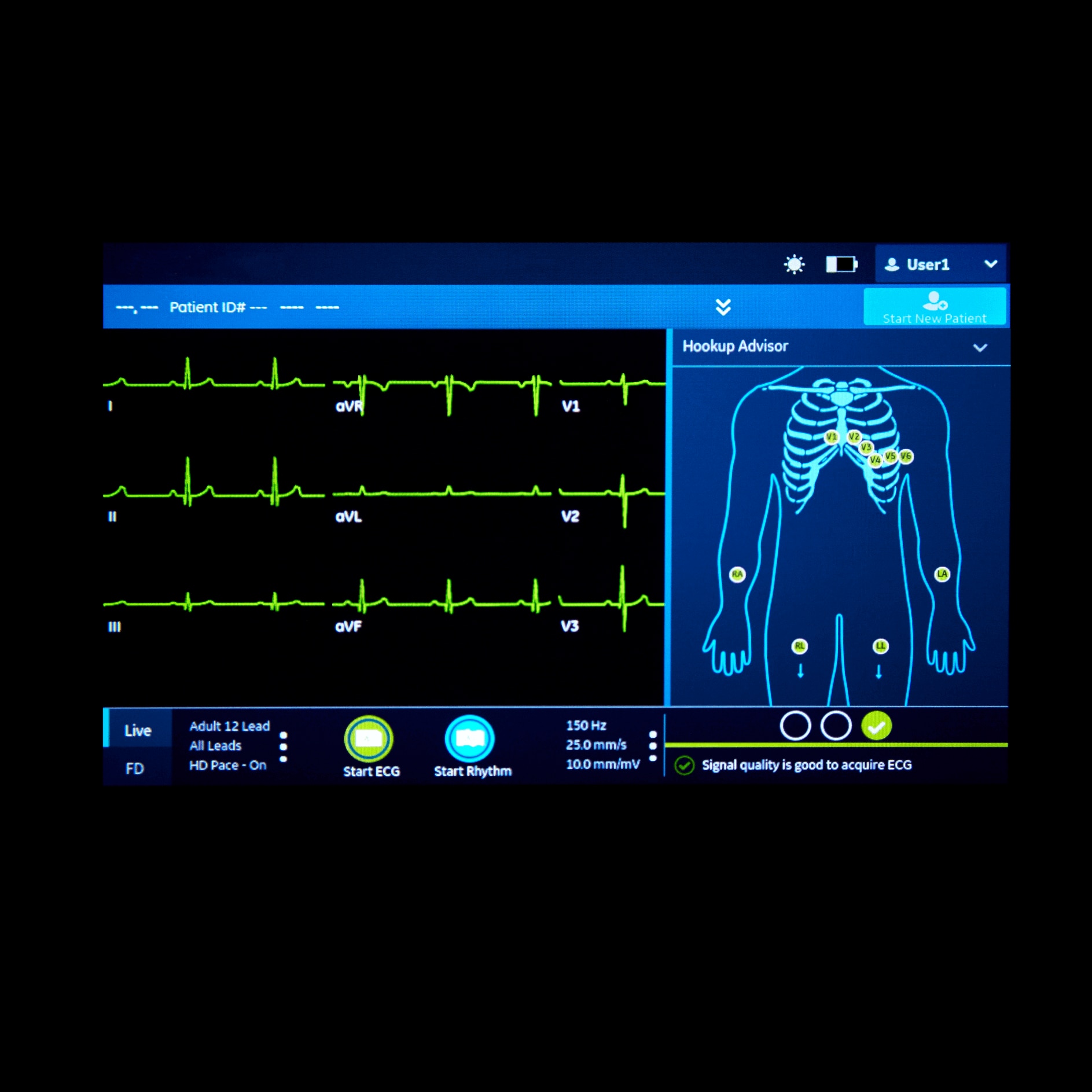 MAC™ 5 Lite Resting ECG MAC™ 5 Lite Resting ECG